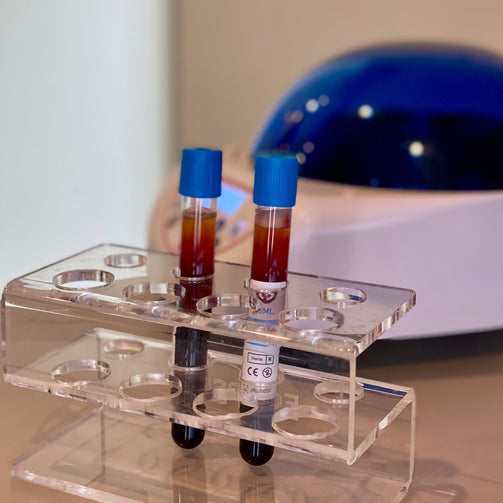 $100 OFF PRP (Hair & Undereyes)